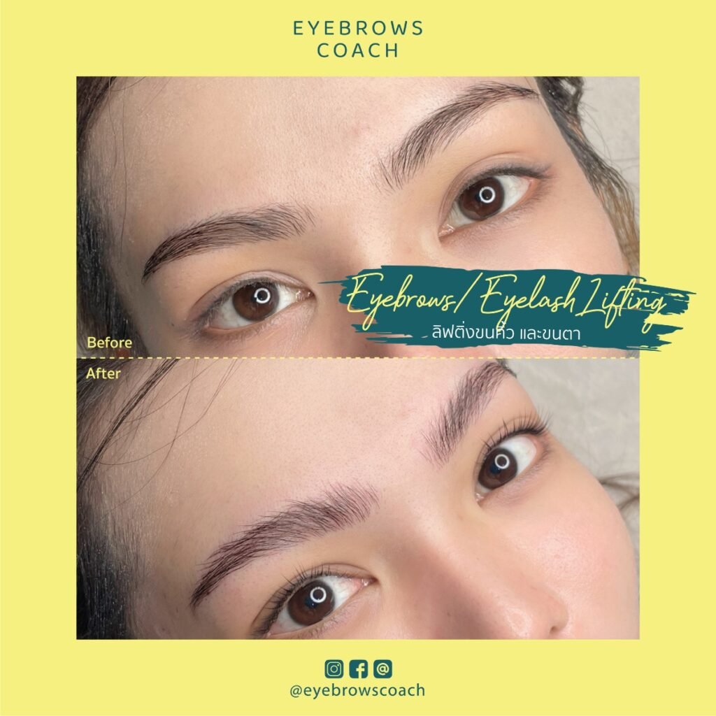 LINE_ALBUM_Used Template_260226_10