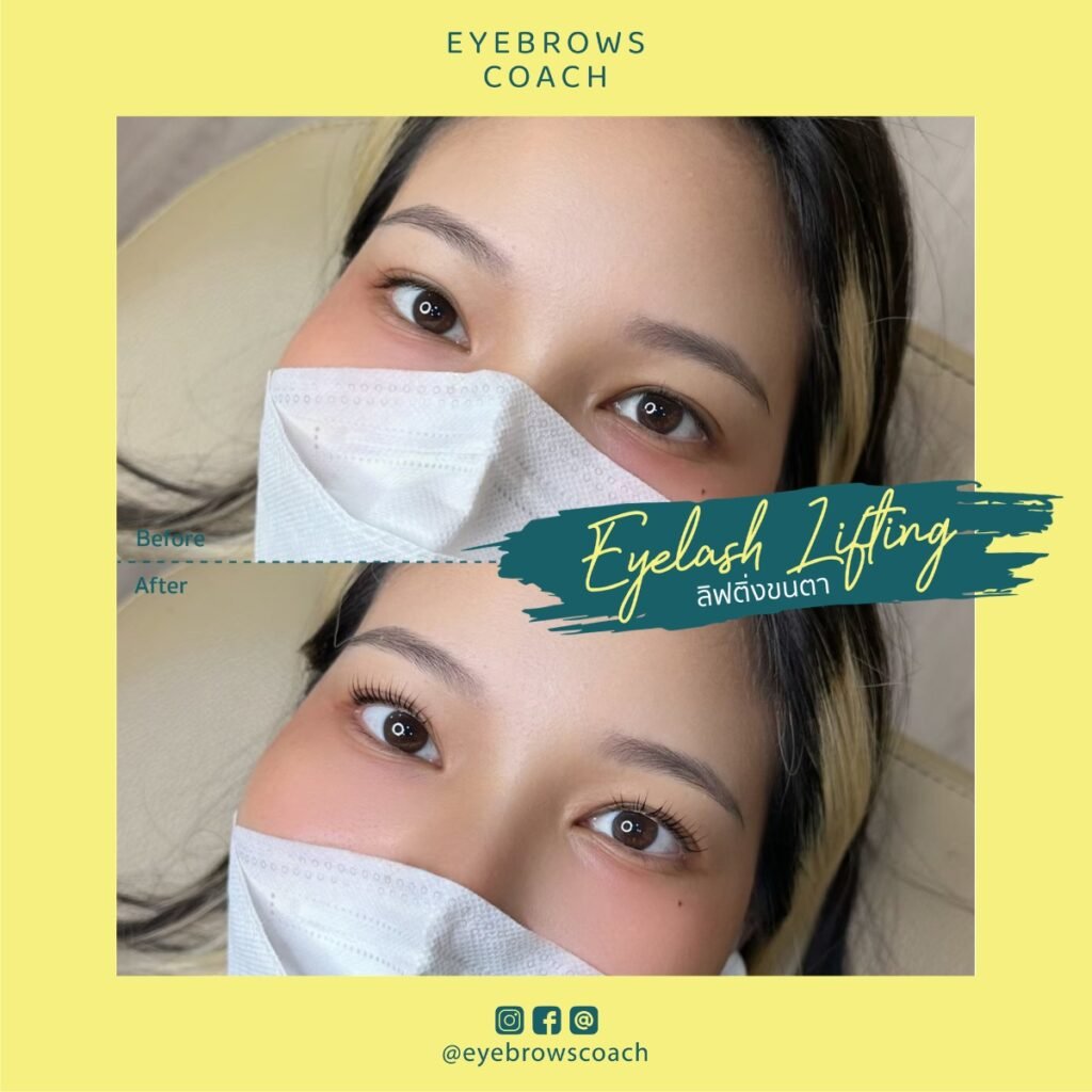 LINE_ALBUM_Used Template_260226_12