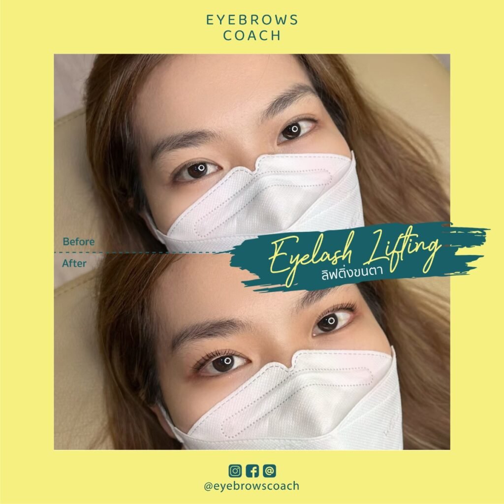LINE_ALBUM_Used Template_260226_15