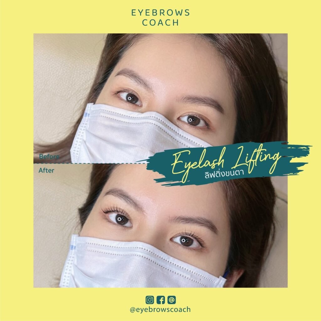 LINE_ALBUM_Used Template_260226_3