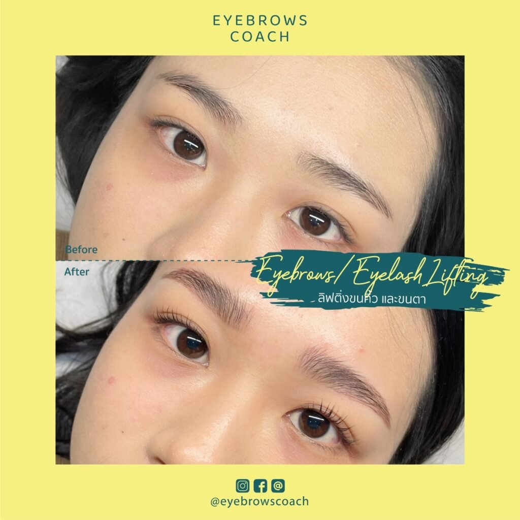 LINE_ALBUM_Used Template_260226_31