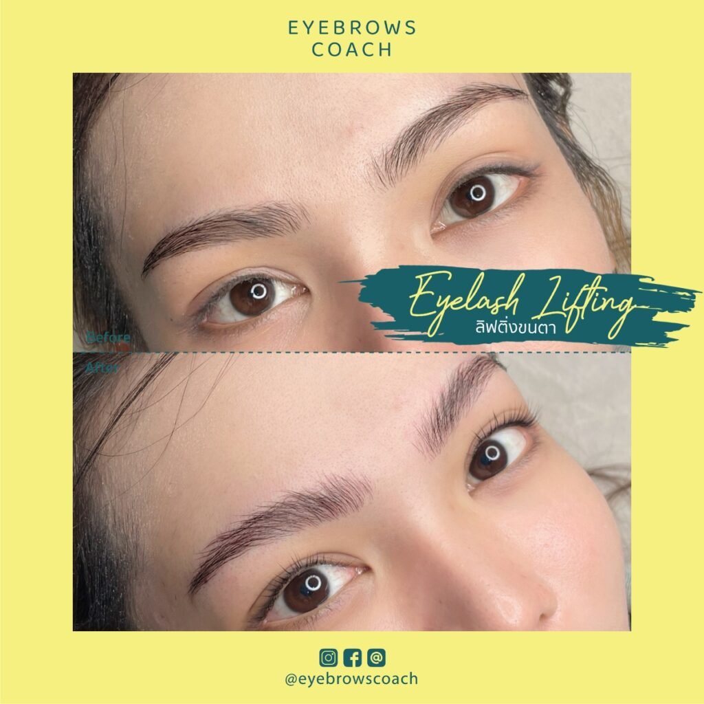 LINE_ALBUM_Used Template_260226_33