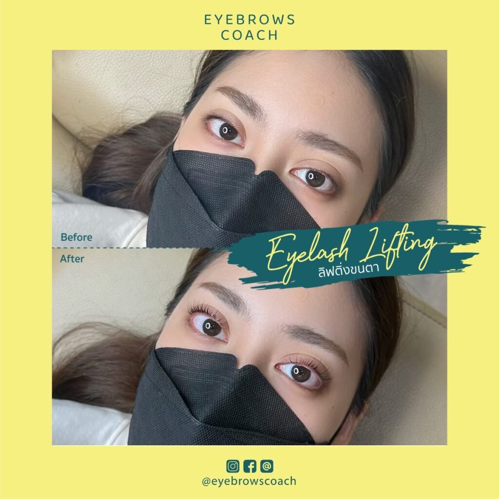 LINE_ALBUM_Used Template_260226_6