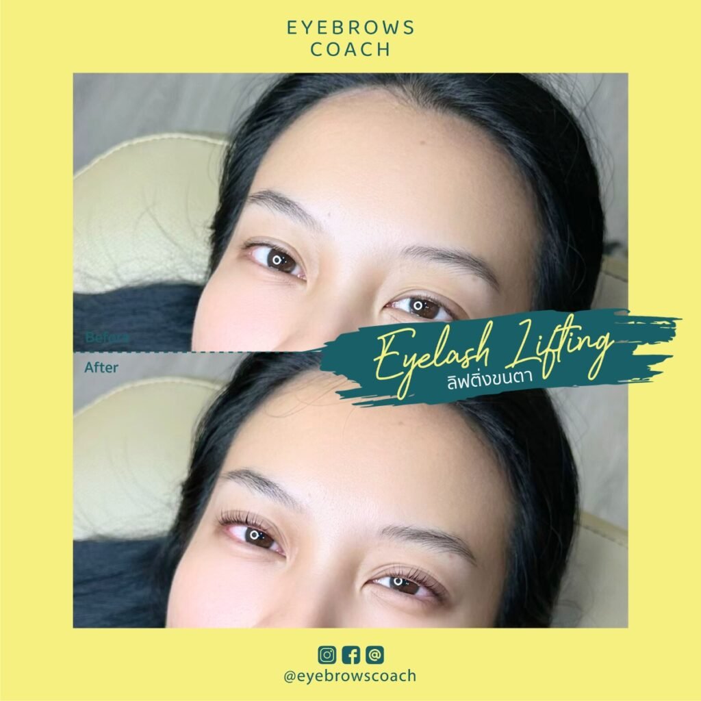 LINE_ALBUM_Used Template_260226_9